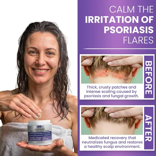 Miniatura 4 de Rida Hair Research Institute Exfoliante Antifúngico para Hombres y Mujeres Anticaspa, Medicado, Exfoliante para Foliculitis para Cuero Cabelludo