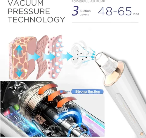 Miniatura 2 de Aspiradora de poros para eliminar puntos negros, limpiador facial recargable por USB, kit de eliminación de puntos negros con 3 potencia de succión