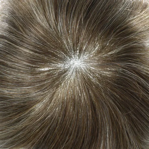 Miniatura 182 de Sistema de repuesto de cabello humano europeo con encaje frontal suizo para hombre, tupé para hombre, pieza de cabello, nudo blanqueado, línea #17