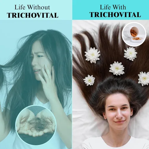 Miniatura 3 de Suplemento avanzado para el crecimiento del cabello para mujeres, biotina, colágeno, zinc y vitaminas esenciales para el cabello A, C y E