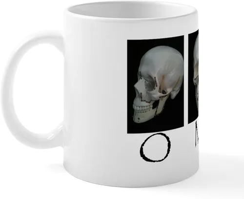 Miniatura 2 de CafePress OMS - Taza quirúrgica con diseño de calavera de 11 oz (11.0 fl oz)