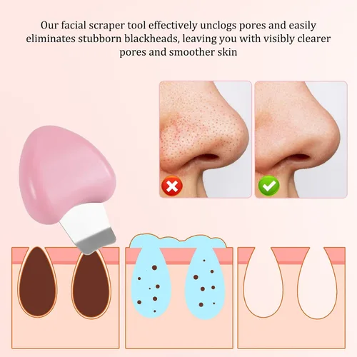 Miniatura 6 de Espátula facial para limpiar la piel, raspador de espinillas, pala de acero inoxidable, kit de herramientas para eliminar puntos negros, agujas