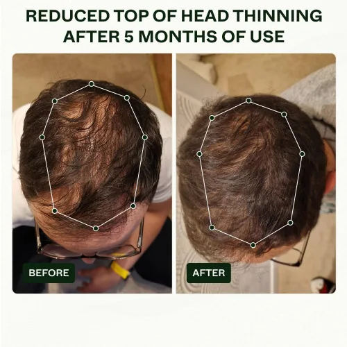 Miniatura 4 de Scandinavian Biolabs Rutina Bio-Pilixin® para hombres Ayuda con el desprendimiento del cabello, nutre los folículos pilosos, mejora la fuerza