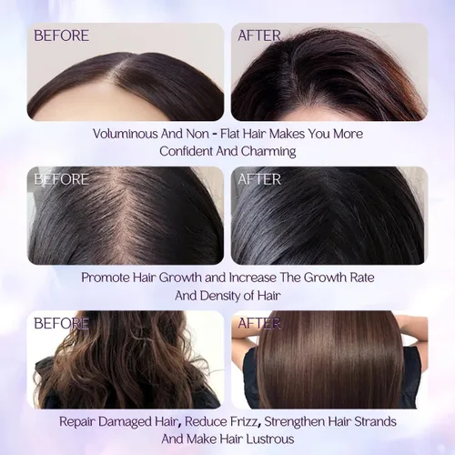 Miniatura 4 de Aceite de batana para el crecimiento del cabello, 100% puro y aceite de batana, mejora el grosor del cabello, evita la pérdida de cabello, repara
