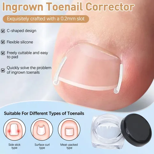 Miniatura 4 de Kits de corrector de uñas encarnadas con tiras curvas, parches transpirables y herramientas de pedicura, juego de cuidado de uñas para una