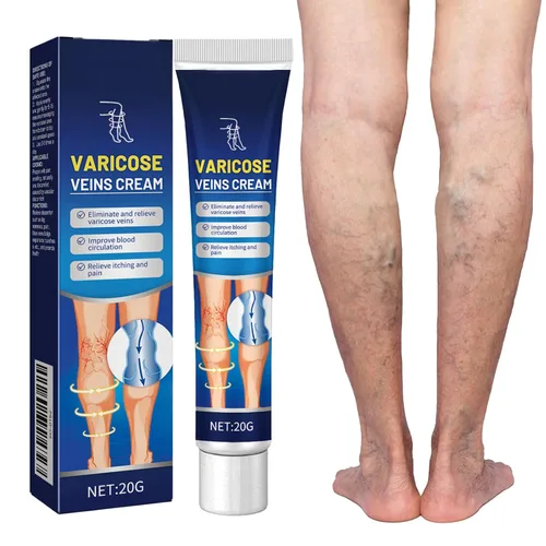 Crema para venas varicosas para piernas, pies y tobillos, crema para el cuidado del edema, mejora la apariencia de la piel y las molestias, alivia