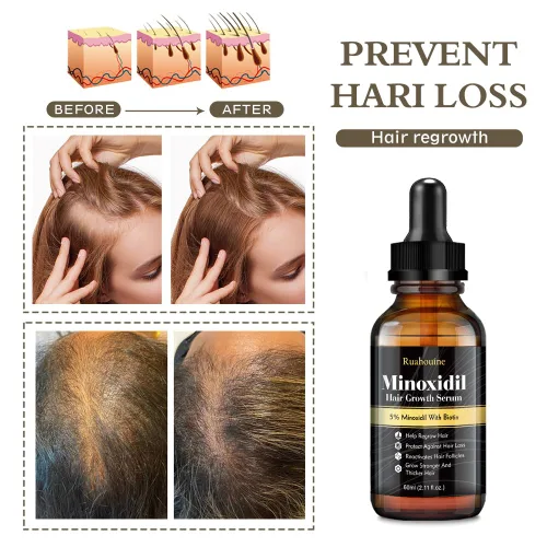 Miniatura 4 de Ruahouine Tratamiento para el crecimiento del cabello para más grueso, 5% de minoxidil biotina aceite de suero para el crecimiento del cabello