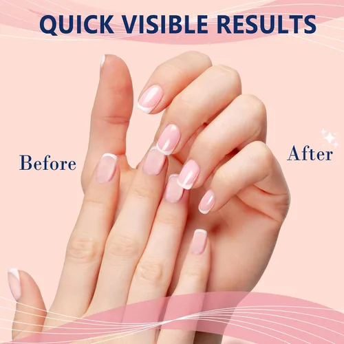 Miniatura 2 de Kit de bloque de brillo de uñas, todo en uno, 4 vías, brillante, pulidor de uñas, bloques suavizantes para uñas naturales, 4