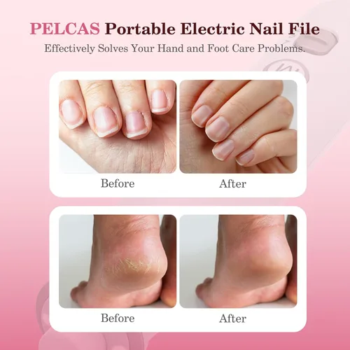 Miniatura 2 de PELCAS Lima de uñas eléctrica, taladro de uñas inalámbrico de 10 velocidades con luz LED, kit portátil de manicura y pedicura, molinillo de uñas
