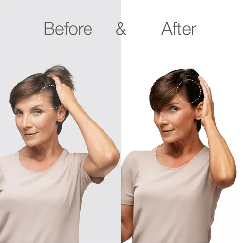 Miniatura 9 de Better Not Younger Suero fortificante para el cabello y el cuero cabelludo para adelgazar y envejecer el cabello, suero para cabello más fuerte