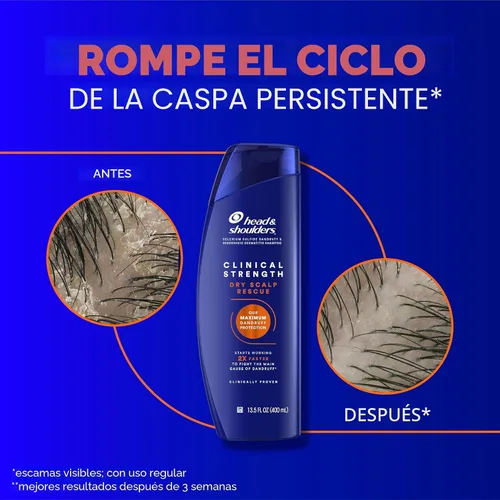 Miniatura 6 de Head & Shoulders - Champú y acondicionador Clinical Strength Dry Scalp Rescue, champú y acondicionador anticaspa y para el cuero cabelludo reseco