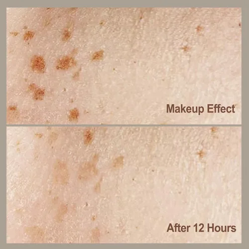Miniatura 3 de Sello de pecas natural como pecas para maquillaje de pecas falsas, cojín impermeable de larga duración, secado rápido, obtén estrellas besadas por