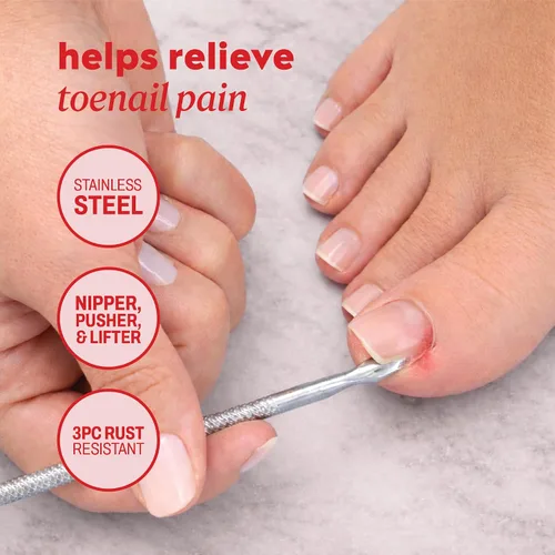 Miniatura 4 de Onyx Professional Kit de uñas encarnadas con cortaúñas y empujador de cutículas de doble extremo, acero inoxidable duradero, kit de eliminación
