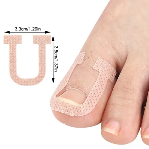 Miniatura 2 de Paquete de 40 parches correctores de uñas encarnadas en forma de U, correctoras de uñas de los pies, parches de corrección, vendajes para alivio