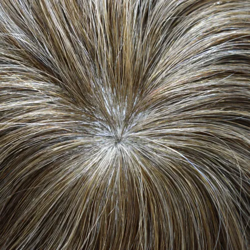 Miniatura 8 de Toupee - Sistema de reemplazo de postizo para hombres, prótesis masculina, pieza de cabello humano de polietileno, piel duradera inyectada