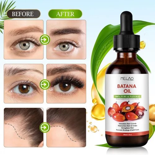 Miniatura 4 de Aceite de batana para el crecimiento del cabello 100% puro y natural, elimina las puntas abiertas, mejora el brillo del cabello y la piel, nutre