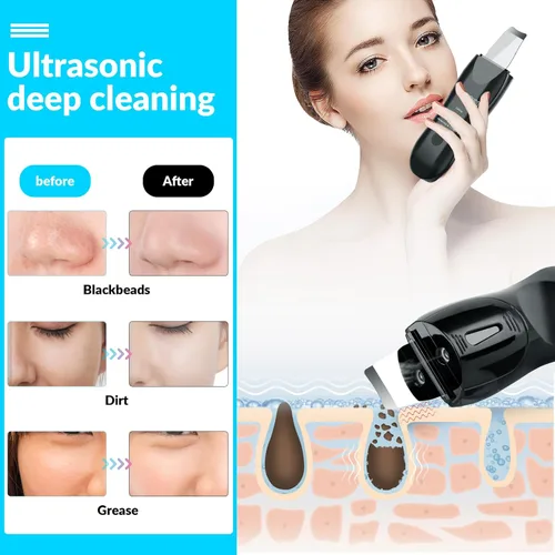 Miniatura 2 de Limpiador facial de piel con pulverizador, pulverizador mejorado, extractor de puntos negros para limpieza profunda e hidratante en aerosol
