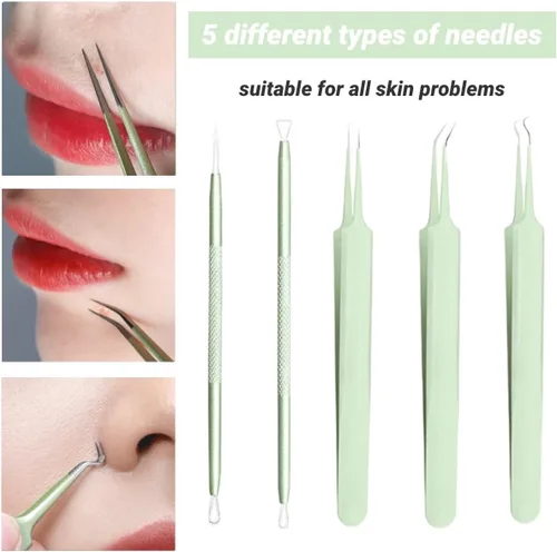 Miniatura 3 de Kit de herramientas para eliminar puntos negros, kit de 5 piezas, kit profesional de eliminación de acné de acero inoxidable para nariz y cara