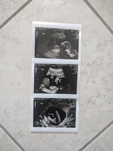 Miniatura 6 de Broma 2D personalizada tira de ultrasonido falso de 3 fotos