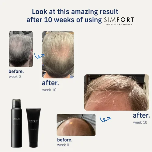 Miniatura 3 de SIMFORT Acondicionador para cabello para hombres y mujeres, recomendado para su uso con champú de ácido carbónico, 4.2 onzas, uso de 1 mes