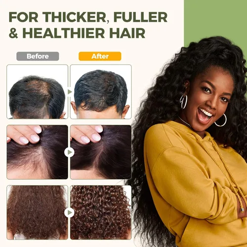 Miniatura 3 de Mixgee Bálsamo de aceite Batana para el crecimiento y grosor del cabello, fórmula natural con batana, aceite de romero y biotina, promueve la salud