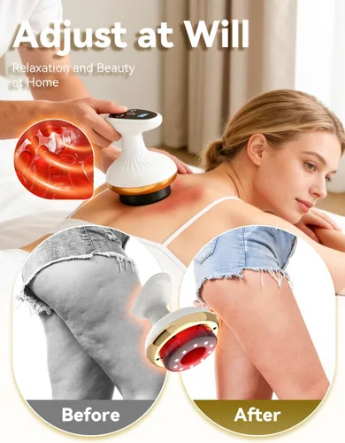Miniatura 4 de Removedor de celulitis, piel más firme, más tonificada, masaje profundo, firmeza natural de la piel, masaje profundo con calor, recargable ayuda a