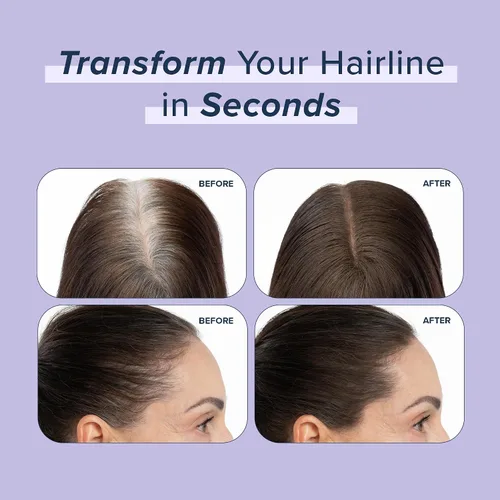 Miniatura 4 de TRUHAIR Polvo prensado para cubrir raíces y cuero cabelludo, compacto, impermeable, cobertura ligera del cabello y encubrimiento de puntos calvos