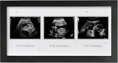 Marco de fotos de ultrasonido – Marco de triple ecograma para la futura mamá | Decoración de álbum de fotos de embarazo | Artículos esenciales para