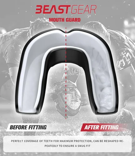 Miniatura 4 de Beast Gear - Beast Guard Pro - Protector bucal (adulto (11+)) para boxeo, artes marciales, rugby, muay thai, hockey, judo, karate, artes marciales