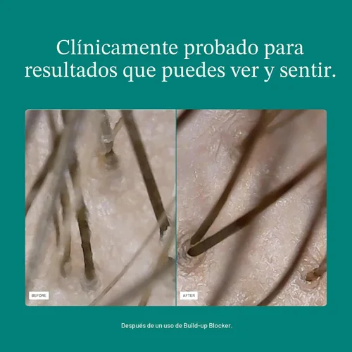 Miniatura 4 de Nutrafol Máscara Exfoliante para el Cuero Cabelludo, Elimina la Acumulación de Productos y el Aceite para un Cabello y Cuero Cabelludo Más
