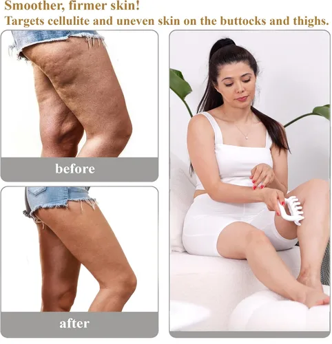 Miniatura 3 de Herramienta de masaje fascia, herramientas de masaje de punto de activación, anti blaster, herramienta de masajeador de celulitis, herramienta