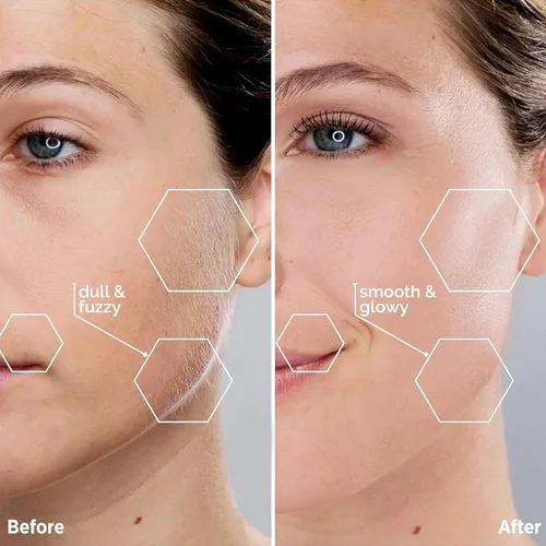 Miniatura 4 de Kradaa Depilación facial para mujeres: maquinilla de afeitar facial eléctrica con luz LED, mini afeitadora sin dolor y resultados instantáneos