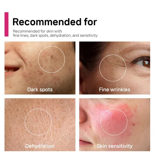 Miniatura 5 de Arbutin 7% + ácido tranexámico 5% + niacinamida 2% crema facial intensiva para el cuidado del tono, manchas oscuras, pecas, manchas, pigmentación