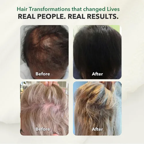 Miniatura 4 de Acondicionador para mujeres y hombres Acondicionador profundo ayurvédico para cabello seco y dañado Productos voluminizadores para el cabello