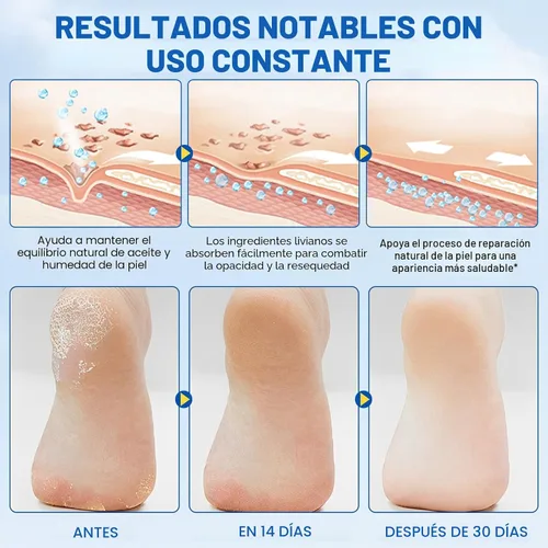 Miniatura 4 de Crema en barra de urea 60% más 2% ácido salicílico, crema de urea para pies y callos de máxima fuerza para talones secos agrietados, manos