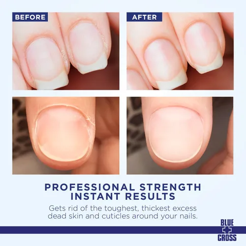 Miniatura 2 de Quitacutículas y suavizante líquido para uñas – Cuidado profesional de uñas Blue Cross con lanolina, tratamiento hidratante para cutículas secas