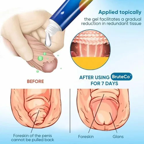 Miniatura 5 de BruteCo - Gel corrector de prepucio redundante, gel corrector para prepucio excesivo, acción rápida y suave (1 unidad)