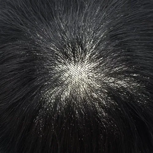 Miniatura 5 de Toupee - Sistema de reemplazo de cabello humano para hombre, encaje mono fino, duradero, línea capilar natural para hombre, pieza de cabello NPU