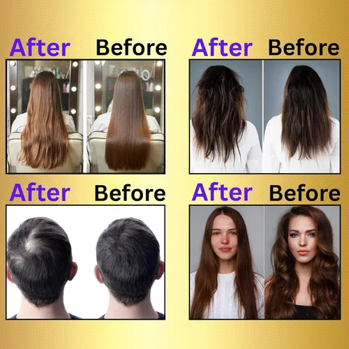 Miniatura 5 de Aceite de jengibre para el crecimiento del cabello, suero de biotina para el crecimiento del cabello, aceite esencial de jengibre natural 100% puro