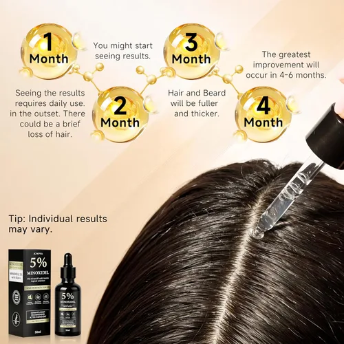 Miniatura 6 de Suero de biotina para el crecimiento del cabello de minoxidil al 5% para hombres y mujeres, solución tópica capilar de minoxidil para el crecimiento