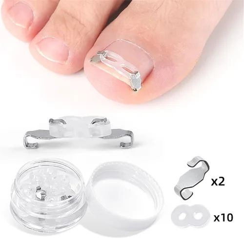 Miniatura 6 de Juego de herramientas de corrección de uñas encarnadas, 2 clips de inserción de acero inoxidable para tratamiento de uñas encarnadas, tiras