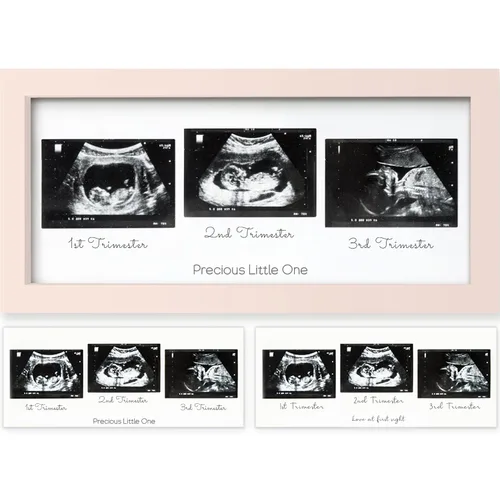 Miniatura 16 de KeaBabies Marco de Fotos de Ecografía para Bebé - Marcos Modernos de Fotos de Ultrasonido para Futuras Mamás, Regalos de Primer Embarazo para Mamá