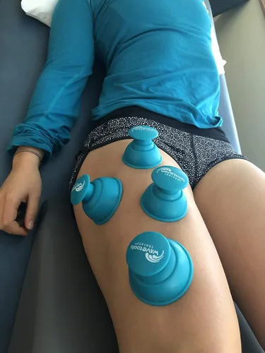 Miniatura 2 de Riptide" Sport Cupping juego de 4 copas de empuje en estuche de Wavetools Therapy ideal para ventosas dinámicas, dos ventosas fuertes