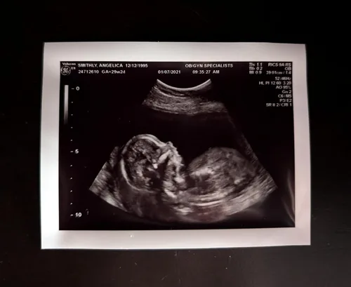 Miniatura 2 de Broma de ultrasonido falso personalizado 2D, foto única SOLO, SIN género