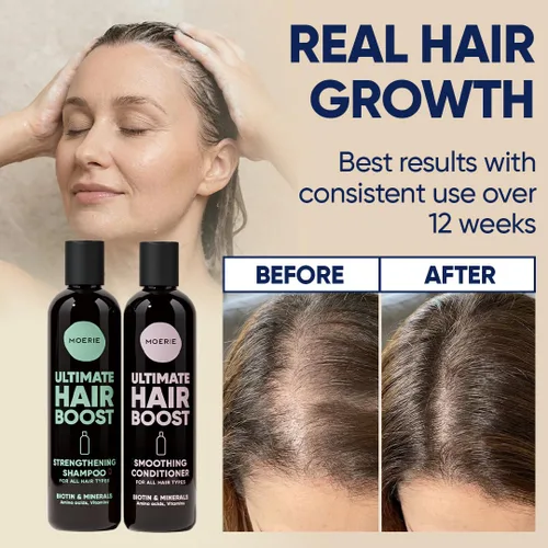 Miniatura 4 de Moerie Champú y acondicionador voluminizador para la caída del cabello - Productos espesantes con ingredientes de origen natural - Más de 100