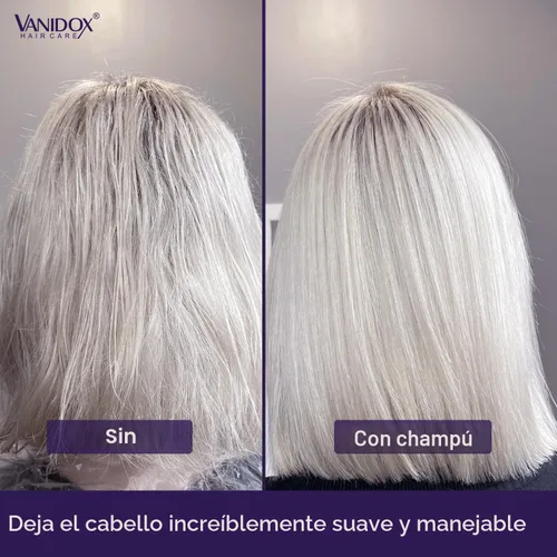 Miniatura 7 de VANIDOX - Juego de champú y acondicionador tonificante púrpura sin sulfato para cabello gris y plateado, hidratante y protector del color, mejora