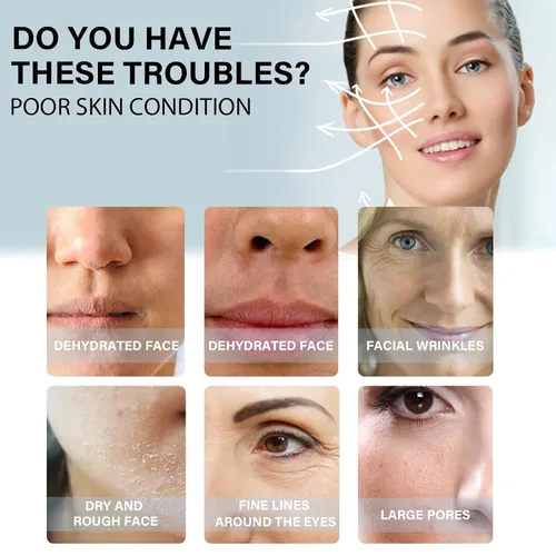 Miniatura 2 de Hilos de proteína soluble coreana, hilos de proteína para el cuidado facial en el hogar, hilo de colágeno soluble para rutina de cuidado de la piel