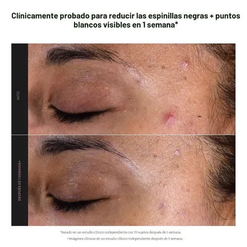 Miniatura 6 de Paula's Choice SKIN PERFECTING 2% BHA Liquid Exfoliant with Salicylic Acid, Facial Polish for Pores, Wrinkles & Fine Lines, Suitable for