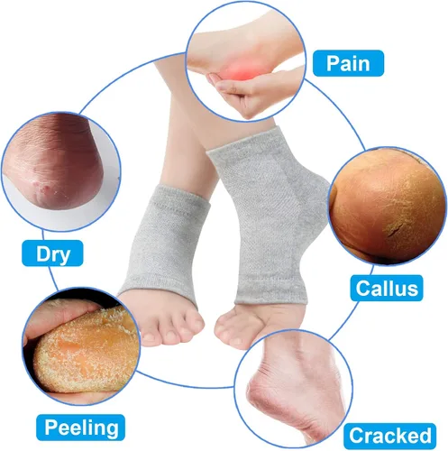 Miniatura 4 de Calcetines de talón de gel hidratantes ventilados, 3 pares de calcetines de spa sin dedos para tratamiento de cuidado de pies, talones agrietados