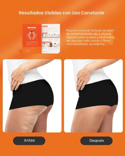 Miniatura 4 de Herramienta de masaje anticelulítico, removedor ergonómico de celulitis para piernas y brazos con asas desmontables, masajeador de drenaje linfático